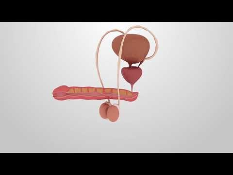 NeoWaves ED Treatment Demo