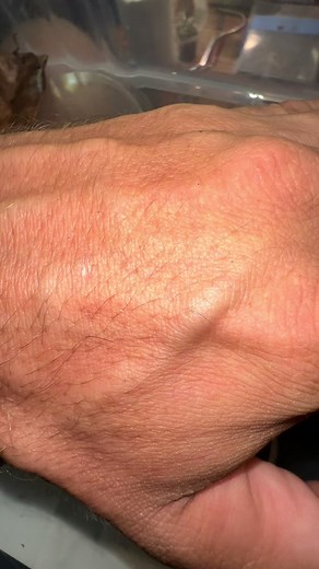 Baby Centipede Update: 13 Perfect Little Plings!