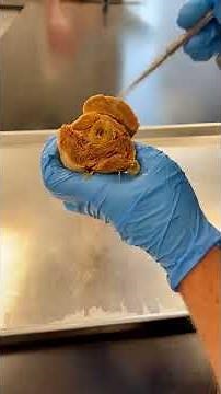 This is REAL Human Bone Marrow