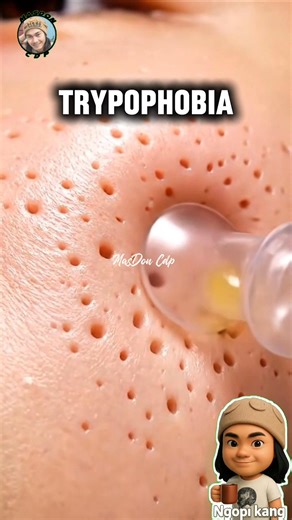 46K views · 109 reactions | This content is AI-generated and is a work of fiction, not based on real events. #Fiction #monster #clipfilm #phobia #trypophobia #spa #clipmovie #movie #shortmovie #Simulation #AI #reels #anomaly #genAi #Entertainment #fblifestyle | MasDon Cdp | Facebook