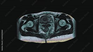 Bulk multicolored MRI of the female pelvic organs, abdominal cavity, gastrointestinal tract and bladder