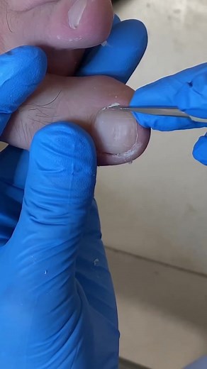 Effective Pedicure Techniques for Nail Care