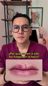 ¿Por qué me vuelven a salir los fuegos en la boca?. #medicina | Dr. William Guerrero