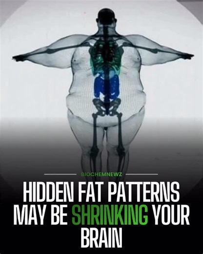 biochemnewz on Instagram: "Researchers from The Affiliated Hospital of Xuzhou Medical University studied MRI scans from almost 26,000 adults to see how different body fat patterns affect brain health. They identified two previously unknown fat profiles that relate to poor brain outcomes: one with high fat in the pancreas and another known as “skinny fat,” where people carry high fat relative to muscle even if they do not look obese. Both patterns were linked to accelerated brain aging, reduced g