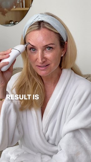 16K views · 15 reactions | An eye lift... in the blink of an eye  Co-Founder & Microcurrent Aesthetician Tera Peterson shares how to instantly lift and smooth the eye area using the TRINITY+ with Effective Lip & Eye Attachment. For the full, step-by-step treatment, follow along in the NuFACE Smart App! | NuFACE | Facebook