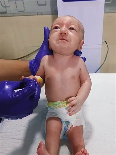 Physiotherapy little baby Dignose with Arthrogryposis Congenital Joint Contracture Care #tiktokgrowthchallenge #prayforbaby #nicubaby #babycriticalcondition #complete10kfollowers