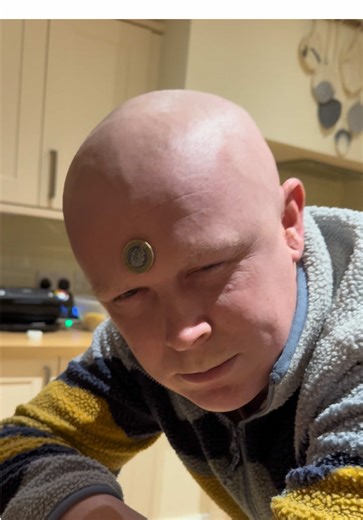 Understanding Side Effects of Chemotherapy in Cancer Patients