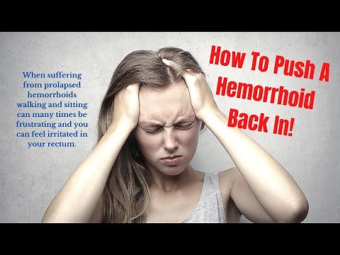 How To Push a Hemorrhoid Back In