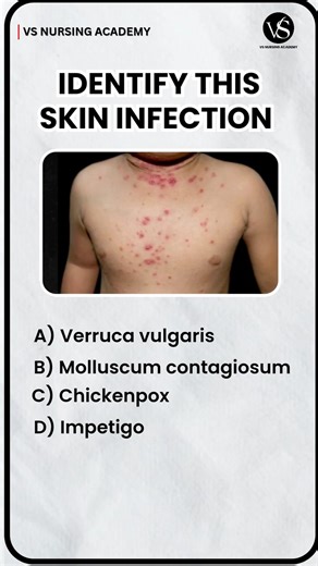 What is the most likely diagnosis? #vsnursingacademy #nursingcompetitiveexam #norcet #nursinglife