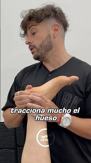 Qué es el espolón calcáneo explicado como un proceso de exostosis