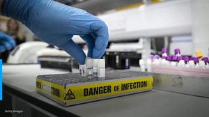 Labs prep for a boom in testing as they anticipate a fall comeback for the flu as COVID still spreads