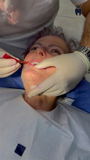 24 reactions | Full mouth restoration for our beautiful patient from...