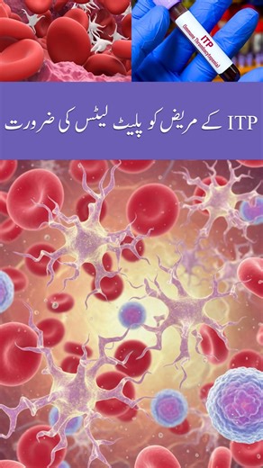 Do ITP Patients Need Platelet Transfusions? The medical answer is generally NO. Treating Immune Thrombocytopenia (ITP) with platelet transfusions is usually useless. The Medical Reason:ITP is an autoimmune condition where the body attacks its own platelets. The "Leaking Bucket" Effect: If you transfuse new platelets, the patient's active antibodies will destroy them within minutes. The count will not rise. Consult with the Expert: For specialized consultation regarding bone marrow transplants an