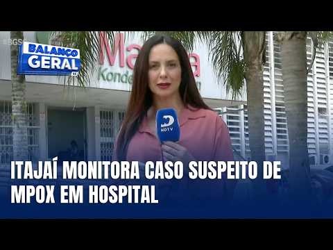 Profissional de saúde é internado com suspeita de mpox em Itajaí