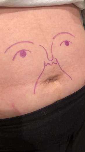 Bump Whistle on TikTok