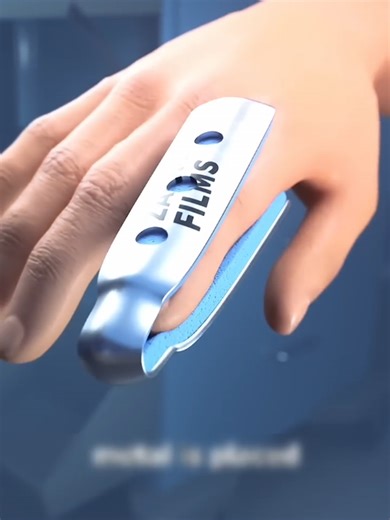 How Do Doctor Fix A Broken Finger?🤯 #3danimation #shortfeed #shorts