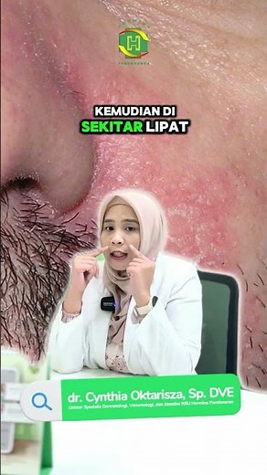 🧴✨ Get to Know Seborrheic Dermatitis ✨🧴 | Hermina Pandanaran