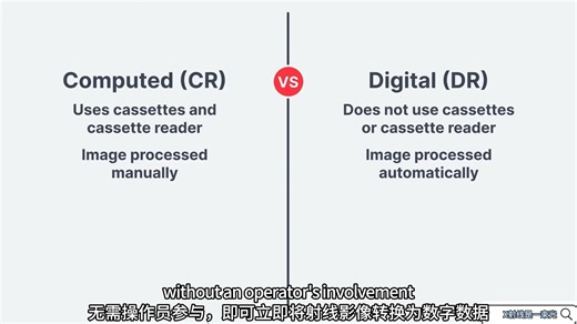 数字X射线成像-DR介绍