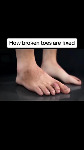 I’ve hit my toe on so many things…😡 #howitworks #howitsmade #toes | Heel Toe