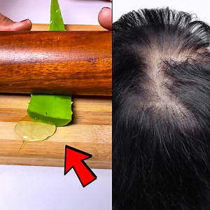 17M views · 73K reactions | Extreme Hair Growth hacks You should try!! #beauty | Artkala4u | Facebook