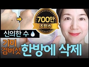 6million views!! Baking soda+OO pack! how to get rid of freckles on the back of hand⭐️Real review⭐️