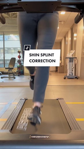 Do you get shin splints when you run? You’re probably running like this! Landing on the outside of your feet increases the speed of foot pronation, which irritates the tibialis posterior muscle to cause shin splints. Shin Splint Correction