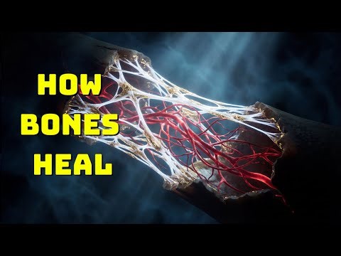 Amazing Time-Lapse: Watch Bone Heal in Real-Time (3D Animation)
