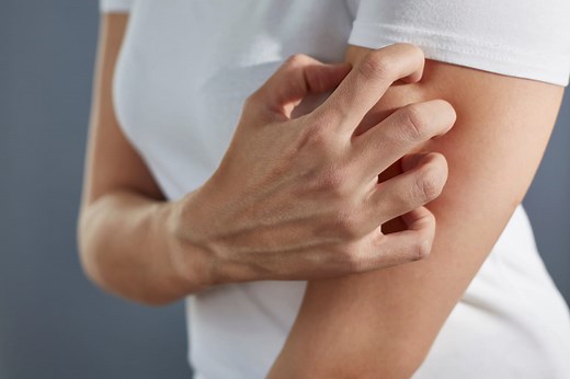 Acariens : piqûre, taille, bouton, allergie, s'en débarrasser