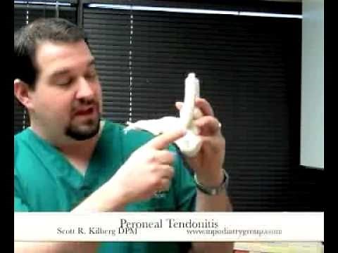Peroneal Tendonitis