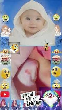 "Satisfying Blackhead Removal – Deep Pimple Popping Close-Up!"