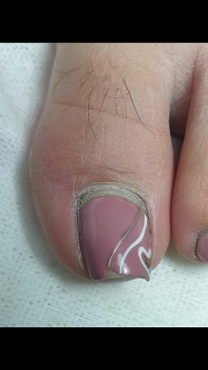 Creative Toenail Art Designs and Care Tips