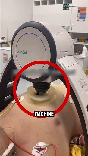 This Robot Does CPR Better Than Humans! 🤖💔 #MedicalTech