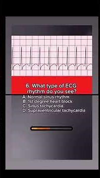 ❤️ Different Heart Rhythms Every Healthcare Worker Should Know!#‪@SmartMedicalKnowledge‬