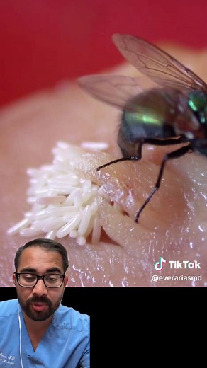 Understanding the Dangers of Fly Eggs in Food