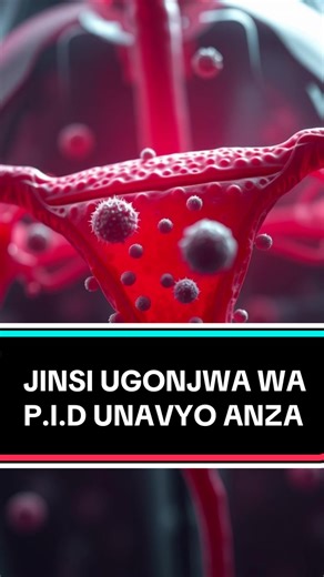 Jinsi Ugonjwa wa P.I.D Unavyo Anza na Sababu Zake