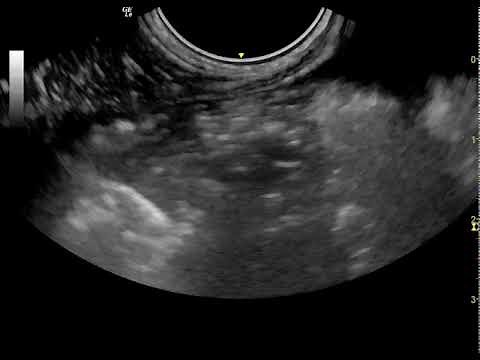 Ultrasonography of canine lung lobe torsion