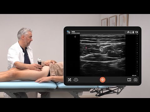 Ultrasound Assessment of the Rectus Femoris Tendon