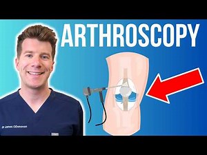 Doctor explains Arthroscopy (Keyhole Surgery) | Hip, Knee, Shoulder and more...