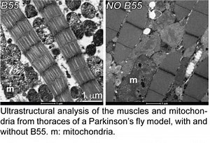 From Parkinson's to Rare Diseases, Discovered a Key Switch for Cellular Health  | Newswise