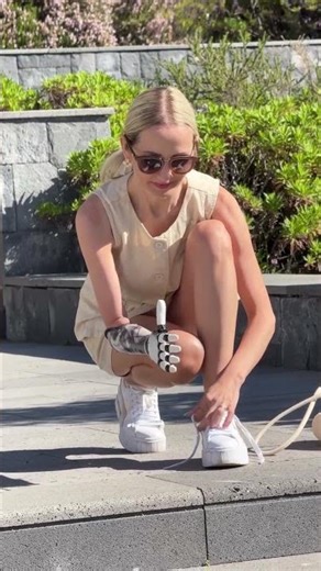 She Tied Her Shoelaces Using Her Artificial Hand… And A Real Smile Unstoppable Confidence #briemode