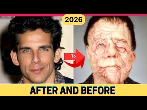 50 Famous Actors You Won’t Recognize Today! (1990s & 2000s Then and Now)