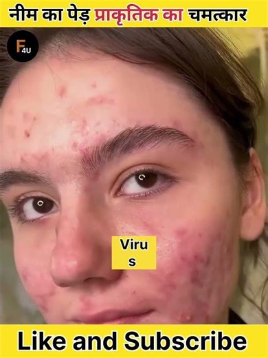 Why Neem Is Called Nature’s Pharmacy ll नीम का पेड़ प्राकृतिक चमत्कार ll #shorts #facts