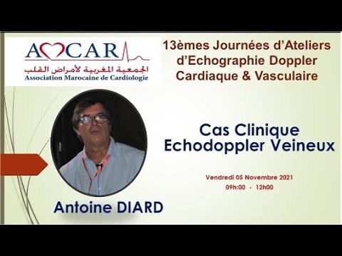 Echo doppler Veineux - Antoine Diard