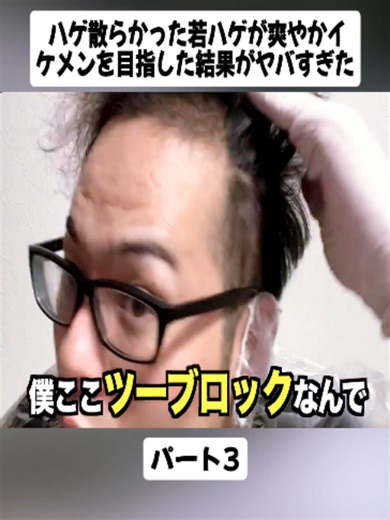 ハゲ散らかった若ハゲが爽やかイケメンを目指した結果がヤバすぎたパート3#若ハゲ #薄毛 #育毛 #髪の毛 #体験談 #人生 #悩み #実話 #videoviraltiktok #japan #foryoupage❤️❤️ #fyp #viral #trending #ilovetiktok