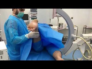 Pulsed epidural catheter radiofrequency