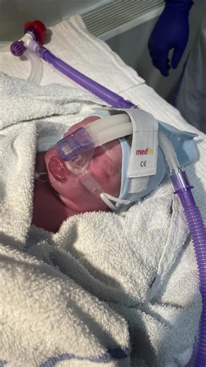 Premature Baby Journey: Then and Now