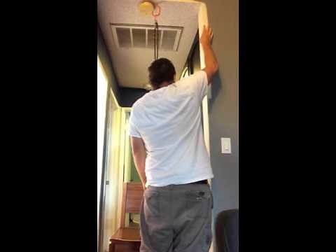 Proximal humerus fracture recovery 5 months after surgery