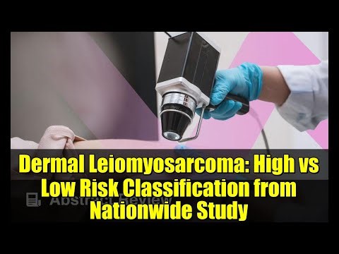 Dermal Leiomyosarcoma: High vs Low Risk Classification from Nationwide Study