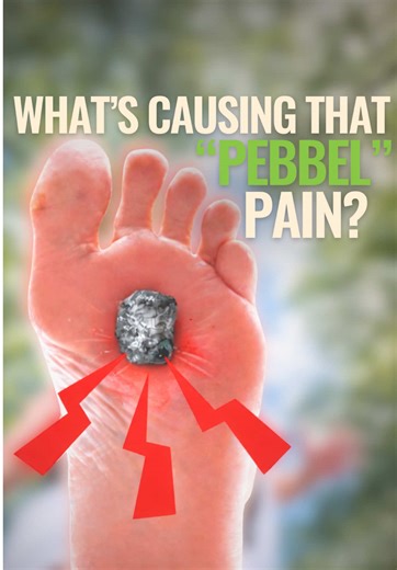 That sharp, burning, pebble-like feeling in your forefoot? It's not random. When the metatarsals compress toward each other, the nerve running between them gets irritated. Over time, this can develop into what's called a Morton's Neuroma. The good news: the foot is adaptable. With the right approach, you can start creating more space, more strength, and more freedom through the forefoot. We've put together a full video on YouTube walking through the mechanics and what to do about it, and if you'