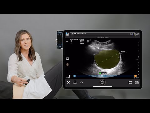Bladder Volume Measurements Using Clarius AI